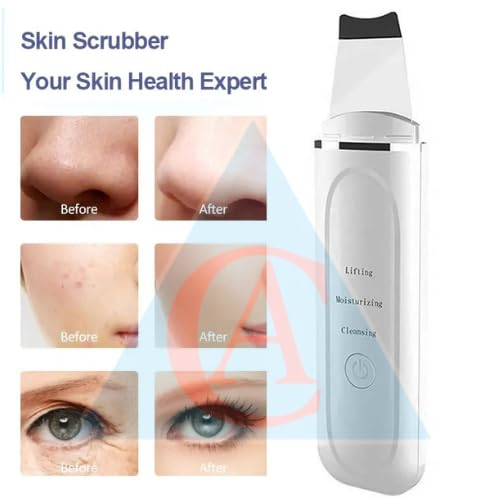 Ultrasonic Facial Skin Scrubber for Wet Skin, Blackheads Remover and Facial Pores Cleaner, Facial Scrubber Spatula, for Facial Deep Cleansing (Standard)