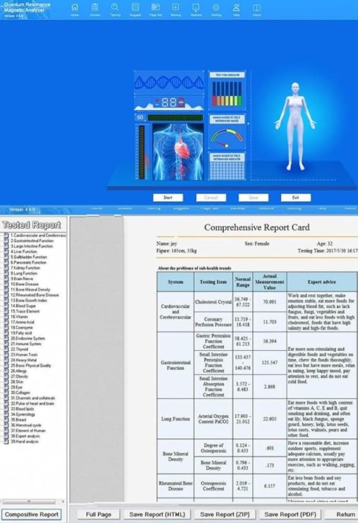 32g+ Quantum Body Analyzer, 32G Bio-Resonance Scanner, Health Checkup Machine with 55 Reports, Windows 7 Compatible